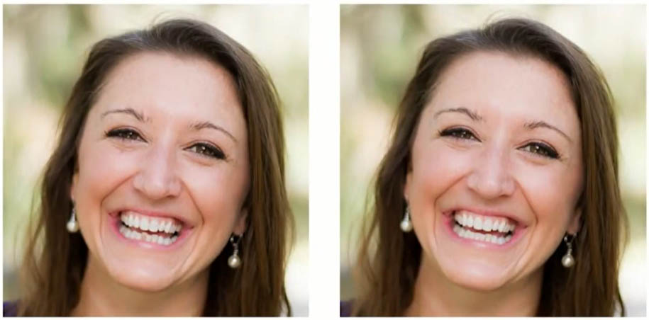 How Your Smile Affects Your Mood and Self-Image