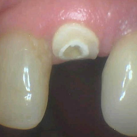 Before