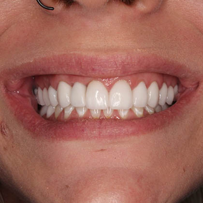 After