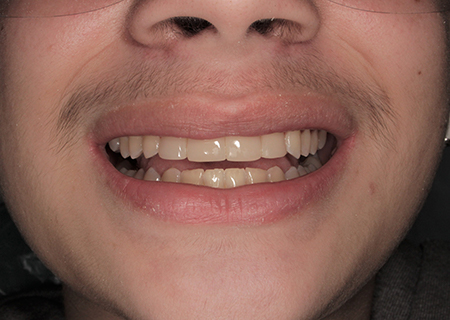 After