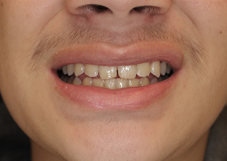 Before