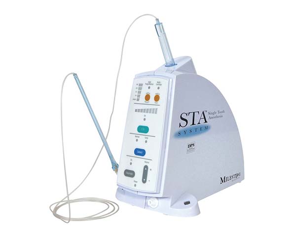 STA Wand - Creating Smiles Dental - Clearwater & St. Petersburg FL