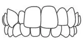 Illustration of upper and lower teeth alignment showing dental bite and smile structure.