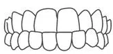 Illustrated dental diagram showing upper and lower teeth alignment and bite positioning.