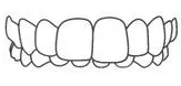 Illustration of upper dental arch showing healthy teeth and gums alignment.