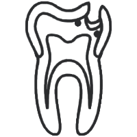 Tooth cross-section diagram showing internal anatomy and root structure for dental education.