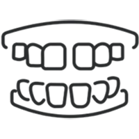 Illustration of upper and lower dental arches showing teeth alignment and bite relationship.