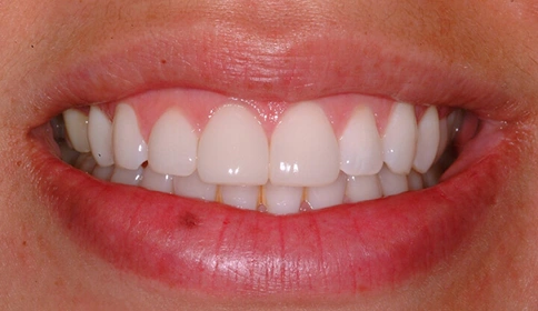 After