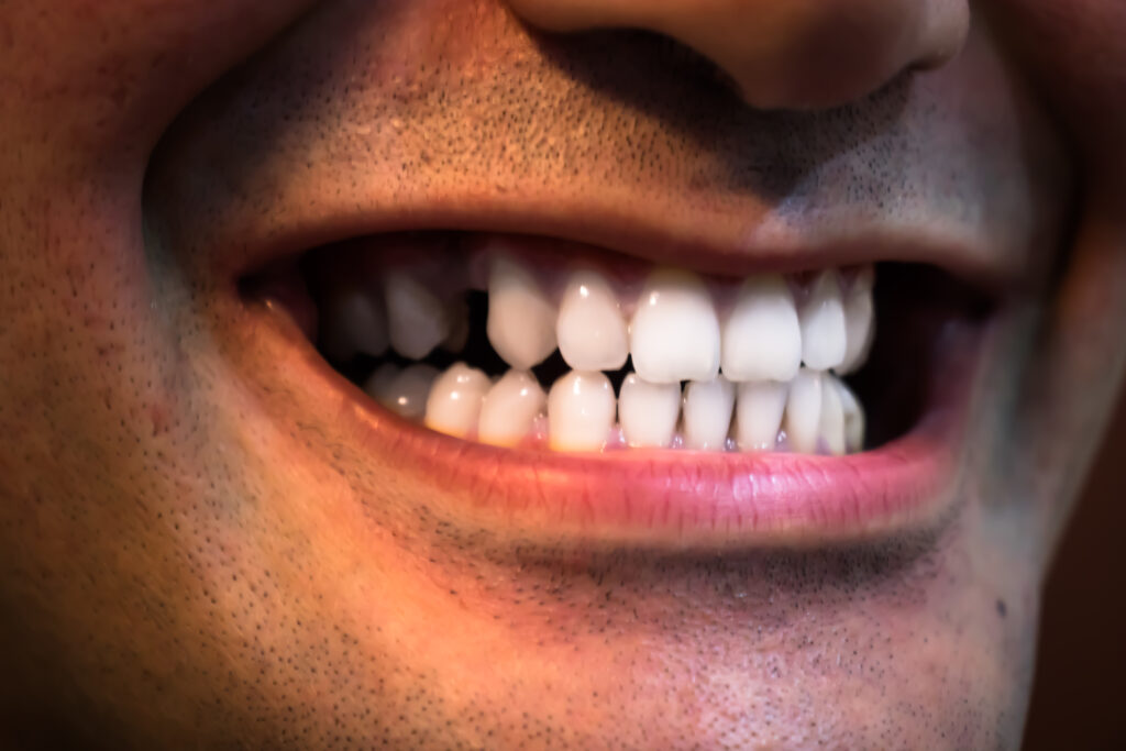 Close-up of a person's mouth smiling, showing clean, white teeth. The skin is slightly textured, conveying warmth and happiness.